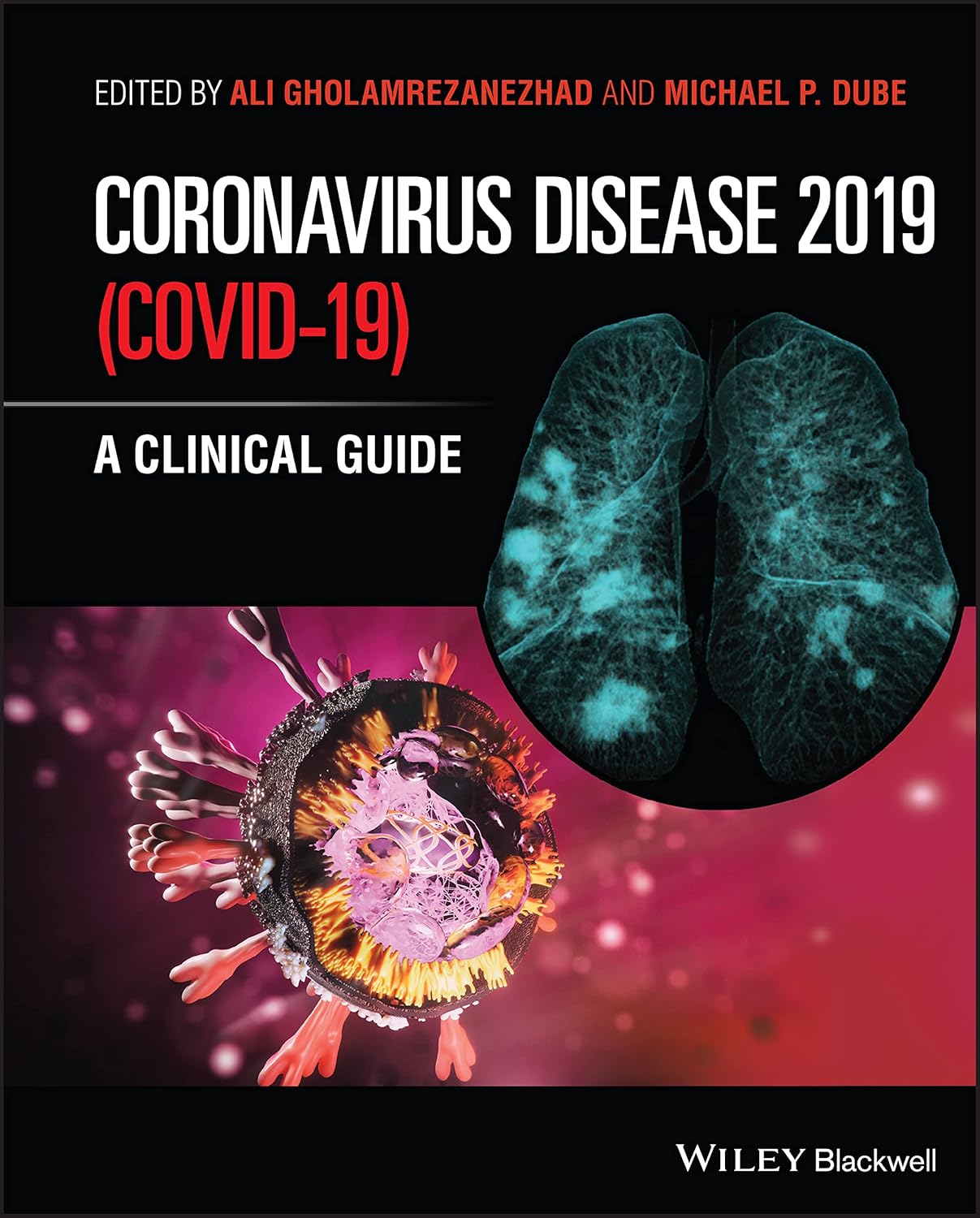 Coronavirus Disease 2019 (Covid-19): A Clinical Guide