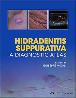 Hidradenitis Suppurativa: A Diagnostic Atlas