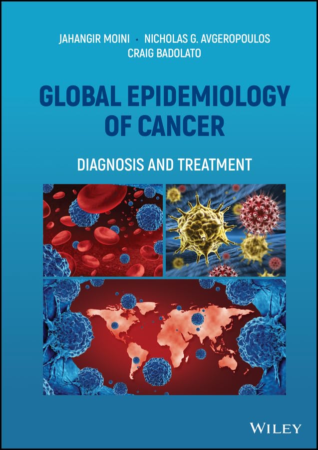 Global Epidemiology of Cancer: Diagnosis and Treatment