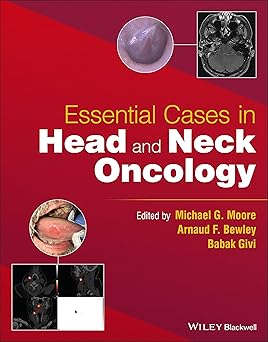 Essential Cases in Head and Neck Oncology